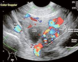 Lire une échographie abdominale