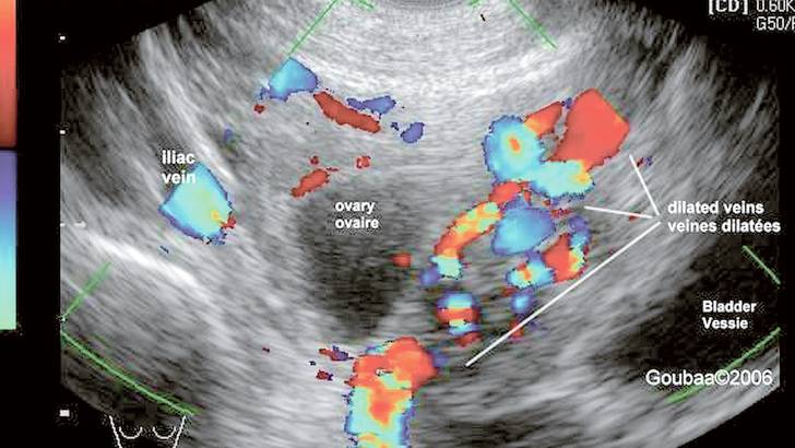 Lire une échographie abdominale