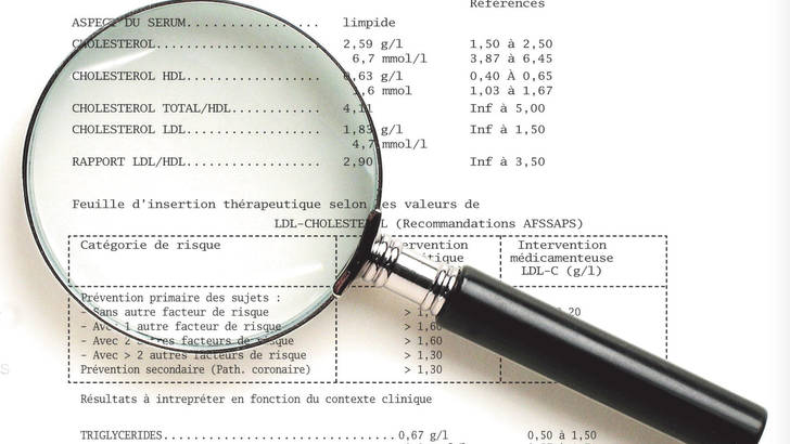 bilan-lipidique-cholesterol-soignez-vous.com