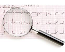 L'electrocardiogramme