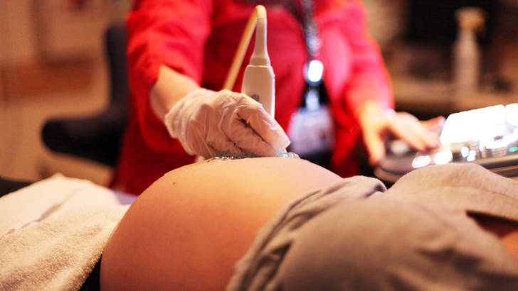 A quoi sert l'echographie pendant la grossesse
