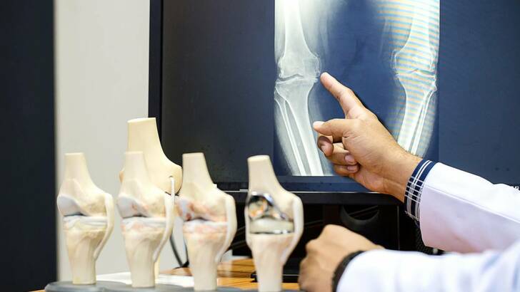Quelles pathologies du genou la chirurgie orthopédique peut-elle corriger ?