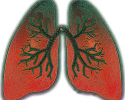 Asthme : Reprendre son souffle