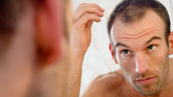 perte-de-cheveux-soignez-vous.com