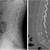 Radiographie du rachis lombaire