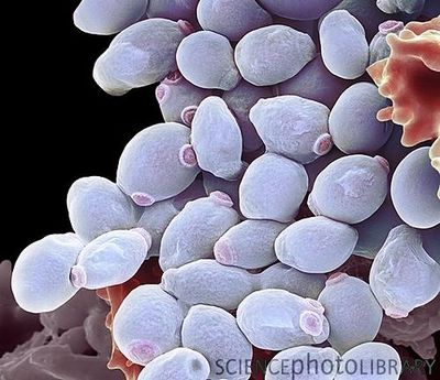 Le candida albicans infeste vos intestins