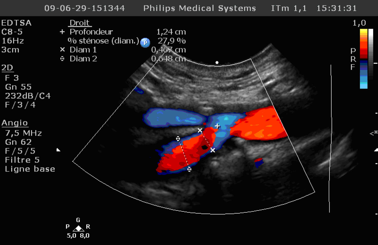 The doppler ultrasound - Analyzes - Treat yourself