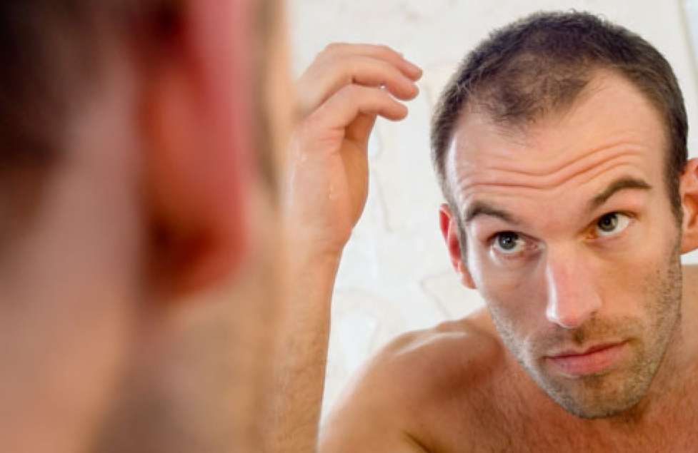 Pour que les cheveux ne tombent pas quelle vitamine
